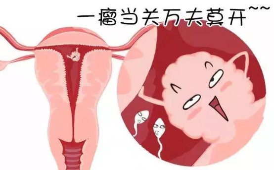肌瘤体质也可以生孩子？加博士另有他法