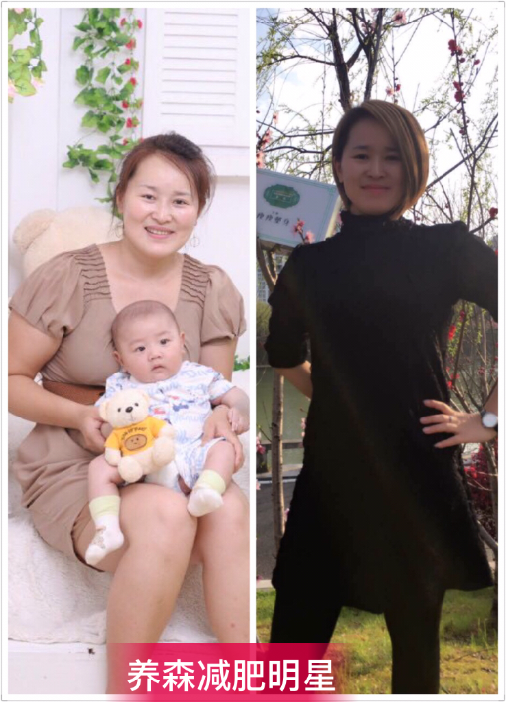 养森瘦瘦包减肥神效让我体重减28斤犹如整容