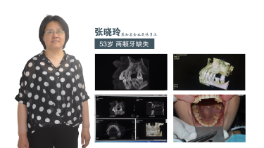 廊坊种植牙直播广播电视台全程报道 