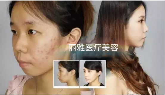 丽雅整形：好看才能放肆，路人整形逆袭变网红!