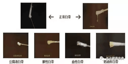 宁波妇科医院排名哪家好_妇科治疗哪里好