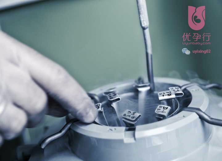 优孕行解答 | 影响俄罗斯试管婴儿成功率的七个关键因素！