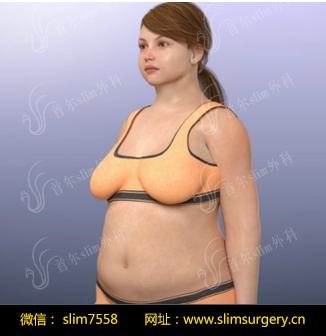 【韩国slim外科】抑制食欲slim ball-胃水球无压力快速减肥