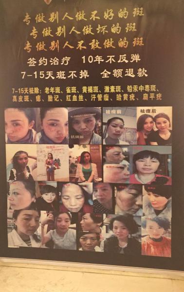 伊人时光全国总代理李老师伊人时光怎么代理？