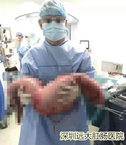 深圳远大肛肠医院：只因便秘不重视，小伙肚子像孕妇
