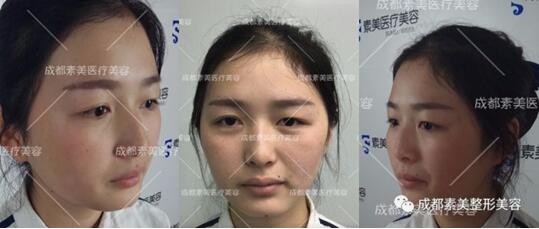 美眼零距离 小莲的素美帕克8度混血美眼记录
