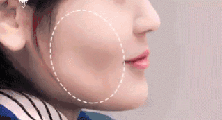 1.gif