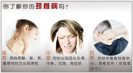 颈椎病用什么膏药效果好 颈椎病的日常护理