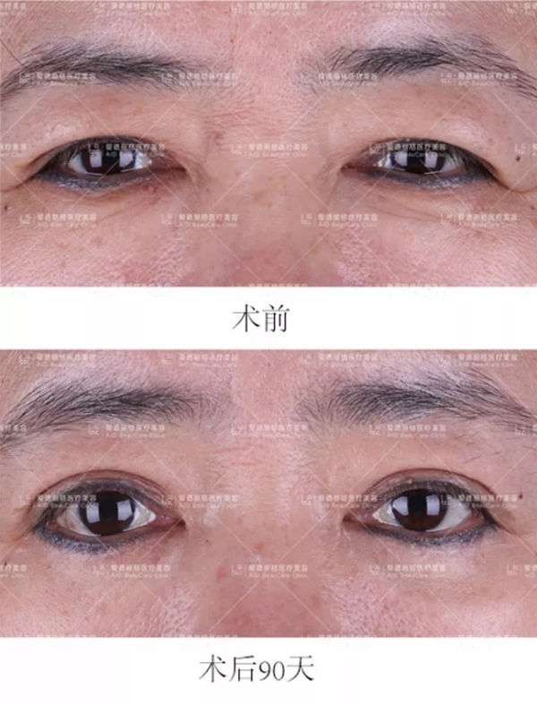 2.webp.jpg