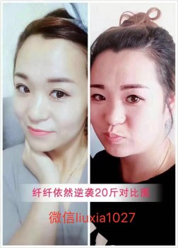 纤纤依然减肥药多少钱，做微商代理加盟要多少钱