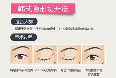 福州美莱华美全切双眼皮好不好