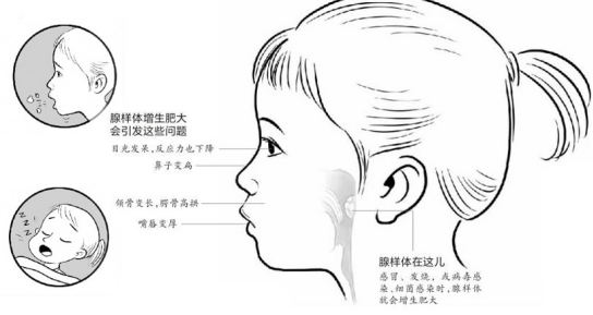山西黄河医院怎么样？耳鼻喉科微创手术成功拯救小公主颜值